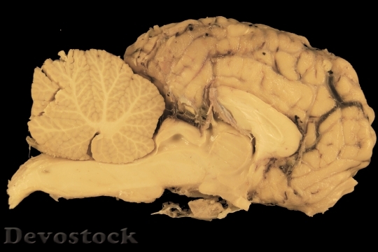 Devostock Brain Horse Section Anatomy HD