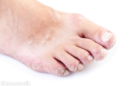 Devostock Skin Allergy  (8)