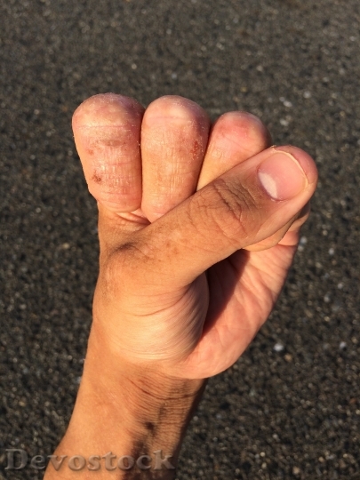 Devostock Hand Finger Nail Wrist 2
