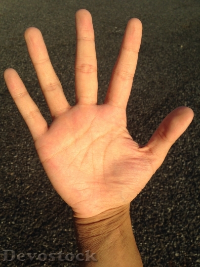 Devostock Palm Hand Finger Bleaching 4